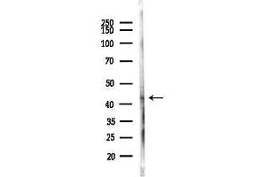 anti-Wilms Tumor 1 Associated Protein (WTAP) (C-Term) antibody