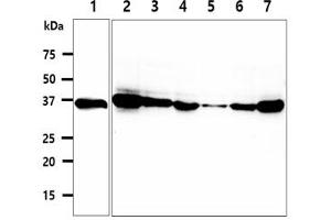 The cell lysates (40ug) were resolved by SDS-PAGE, transferred to PVDF membrane and probed with anti-human CPOX antibody (1:500). (CPOX anticorps)