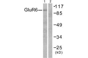 Western blot analysis of extracts from mouse brain, using GluR6 antibody (ABIN5976413).