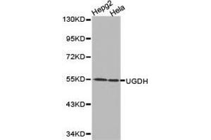 Western Blotting (WB) image for anti-UDP-Glucose 6-Dehydrogenase (UGDH) antibody (ABIN1875273) (UGDH anticorps)