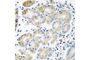 Immunohistochemistry of paraffin-embedded human stomach using PLS3 antibody at dilution of 1:100 (40x lens). (Plastin 3 anticorps)