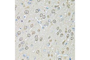 Immunohistochemistry of paraffin-embedded rat brain using PSMB1 antibody.