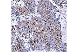 IHC analysis of p57 Kip2/CDKN1C using anti-p57 Kip2/CDKN1C antibody (ABIN7603232). (CDKN1C anticorps  (N-Term))