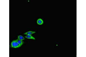 Immunofluorescent analysis of HepG2 cells using ABIN7148044 at dilution of 1:100 and Alexa Fluor 488-congugated AffiniPure Goat Anti-Rabbit IgG(H+L) (Cofilin anticorps  (AA 4-144))
