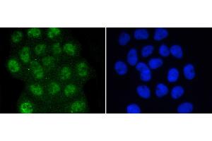 A431 were fixed in paraformaldehyde, permeabilized with 0.