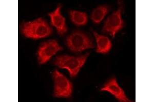 ABIN6276225 staining COLO205 by IF/ICC. (TAS2R20 anticorps  (Internal Region))