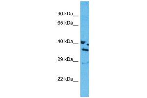 Western Blotting (WB) image for anti-Olfactory Receptor, Family 13, Subfamily J, Member 1 (OR13J1) (C-Term) antibody (ABIN2791823) (OR13J1 anticorps  (C-Term))