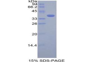 SDS-PAGE analysis of Mouse Cystatin A Protein. (CSTA Protéine)