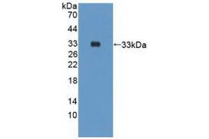 Western blot analysis of recombinant Human PIK3Cd. (PIK3CD anticorps  (AA 774-1044))