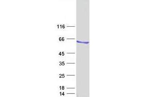 Validation with Western Blot