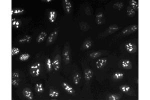 Immunofluorescent staining of U-2 OS (ATCC HTB-96) cells. (Ki-67 anticorps  (AA 1547-1742))