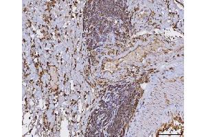 IHC analysis of HLA-DRA using anti-HLA-DRA antibody (ABIN7600950).
