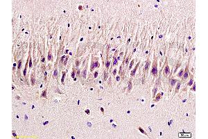Formalin-fixed and paraffin embedded rat brain labeled with Rabbit Anti 5-HTR2A/HTR2A Polyclonal Antibody, Unconjugated (ABIN737016) at 1:200 followed by conjugation to the secondary antibody and DAB staining (HTR2A anticorps  (AA 65-160))