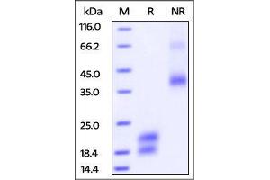 Vascular Endothelial Growth Factor (VEGF) (AA 27-147) (Active) protein (AVI tag,His tag,Biotin)