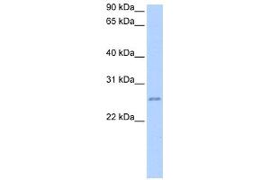 WB Suggested Anti-RPESP Antibody Titration: 0. (RPESP anticorps  (C-Term))