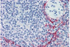 Human Spleen (formalin-fixed, paraffin-embedded) stained with MADCAM1 antibody ABIN462006 at 10 ug/ml followed by biotinylated anti-mouse IgG secondary antibody ABIN481714, alkaline phosphatase-streptavidin and chromogen. (MADCAM1 anticorps)