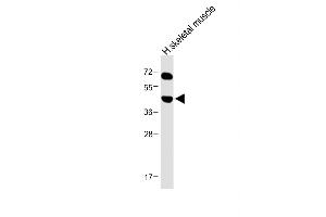 Anti-KERA Antibody (C-term) at 1:1000 dilution + Human skeletal muscle lysate Lysates/proteins at 20 μg per lane.