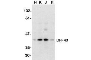 Western blot analysis of DFF40/CAD in HeLa (H), K562 (K), Jurkat (J), and Raji (R) whole cell lysate with DFF40/CAD antibody at 1μg/ml. (DFFB anticorps  (AA 147-164))