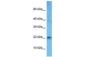 Host:  Rabbit  Target Name:  Hand2  Sample Type:  Mouse Heart lysates  Antibody Dilution:  1. (HAND2 anticorps  (C-Term))