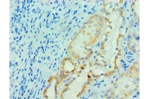 Immunohistochemistry of paraffin-embedded human kidney tissue using ABIN7165064 at dilution of 1:100 (PRMT1 anticorps  (AA 20-353))