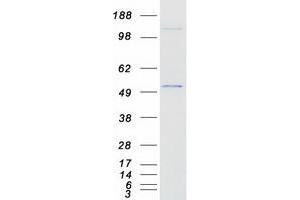 Validation with Western Blot