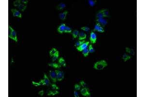 Immunofluorescence staining of PC-3 cells with ABIN7166148 at 1:266, counter-stained with DAPI.