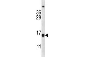 BCL2 antibody western blot analysis in Jurkat lysate