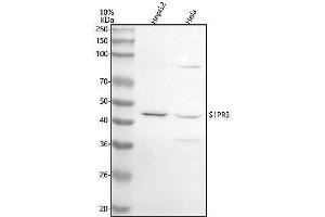 Western blot analysis of EDG3 using anti-EDG3 antibody (ABIN7604713).