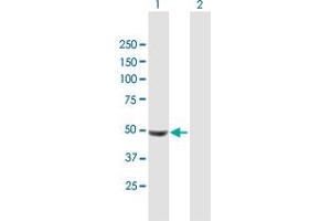 Western Blot analysis of UCKL1 expression in transfected 293T cell line by UCKL1 MaxPab polyclonal antibody. (UCKL1 anticorps  (AA 1-419))