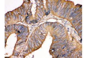 Immunohistochemistry (Paraffin-embedded Sections) (IHC (p)) image for anti-TF (AA 20-49), (N-Term) antibody (ABIN3043419) (TF (AA 20-49), (N-Term) anticorps)