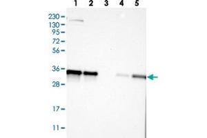 Western blot analysis of Lane 1: RT-4, Lane 2: U-251 MG, Lane 3: Human Plasma, Lane 4: Liver, Lane 5: Tonsil with KCTD10 polyclonal antibody  at 1:250-1:500 dilution. (KCTD10 anticorps)