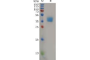 Human Protein, hFc Tag on SDS-PAGE under reducing condition.