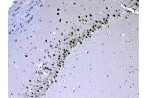 IHC analysis of CHD2 using anti-CHD2 antibody .