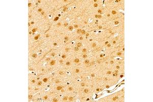 Immunohistochemistry of paraffin embedded mouse brain using scr3 (ABIN7074886) at dilution of 1:1000 (400x lens)