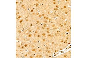 Immunohistochemistry of paraffin embedded mouse brain using scr3 (ABIN7074886) at dilution of 1:1000 (400x lens) (NCOA3 anticorps)