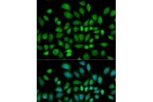 anti-phosphodiesterase 4D, cAMP-Specific (PDE4D) antibody
