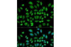 Immunofluorescence analysis of HeLa cells using PDE4D Polyclonal Antibody
