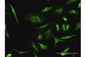 Immunofluorescence of purified MaxPab antibody to PDHA2 on HeLa cell.