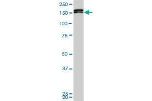 MLLT10 monoclonal antibody (M01), clone 6H8. (MLLT10 anticorps  (AA 695-793))