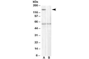 Western blot testing of human EBV-immortilized lymphoblastoid lysate with SIPA1 antibody at 1ug/ml, with (B) and without (A) immunizing peptide. (SIPA1 anticorps)