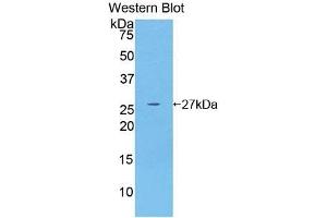Detection of Recombinant GSTm4, Human using Polyclonal Antibody to Glutathione S Transferase Mu 4 (GSTm4) (GSTM4 anticorps  (AA 18-215))