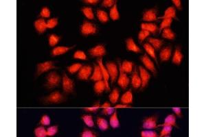 Immunofluorescence analysis of HeLa cells using BMP6 Polyclonal Antibody at dilution of 1:100. (BMP6 anticorps)