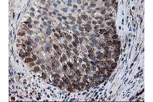 Image no. 5 for anti-Dihydrolipoamide Dehydrogenase (DLD) antibody (ABIN1497846) (DLD anticorps)