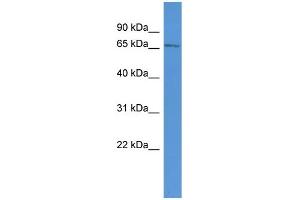WB Suggested Anti-Apbb1ip Antibody Titration: 0.