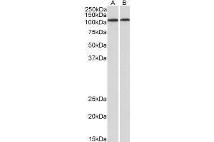 ABIN2613394 (1µg/ml) staining of Human Heart (A) and Kidney (B) lysates (35µg protein in RIPA buffer). (BMP1 anticorps  (AA 284-296))