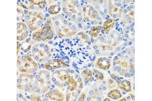 Immunohistochemistry of paraffin-embedded Mouse kidney using PRKAG1 Polyclonal Antibody at dilution of 1:100 (40x lens).