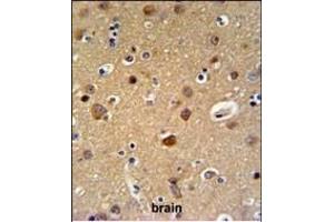 TELO2 Antibody (C-term) (ABIN651003 and ABIN2840034) IHC analysis in formalin fixed and paraffin embedded brain tissue followed by peroxidase conjugation of the secondary antibody and DAB staining. (TELO2 anticorps  (C-Term))