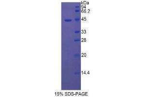 SDS-PAGE of Protein Standard from the Kit (Highly purified E. (TPSAB1 Kit ELISA)