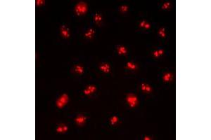 Immunofluorescent analysis of CDYL2 staining in HepG2 cells.
