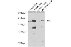 Western blot analysis of extracts of various cell lines, using PPL antibody (ABIN6128532, ABIN6146036, ABIN6146038 and ABIN6222699) at 1:1000 dilution. (PPL anticorps  (AA 1-130))